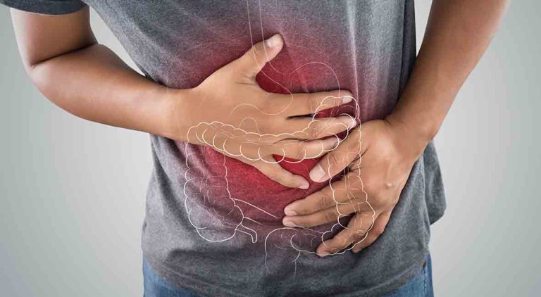 How to Tell if You Have Inflammatory Bowel Disease